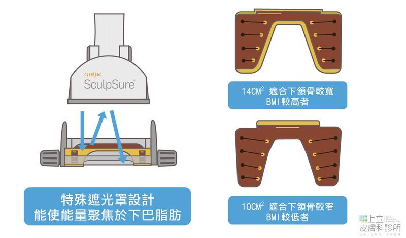 SculpSure熱塑溶脂（絲酷秀）平貼式探頭搭配特殊遮光罩設計，使能量聚焦於下巴卻不會挑選脂肪厚度